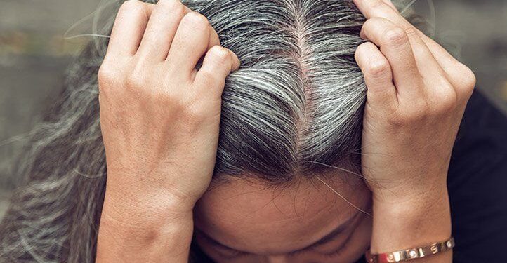 جلوگیری از سفید شدن موها براثر استرس